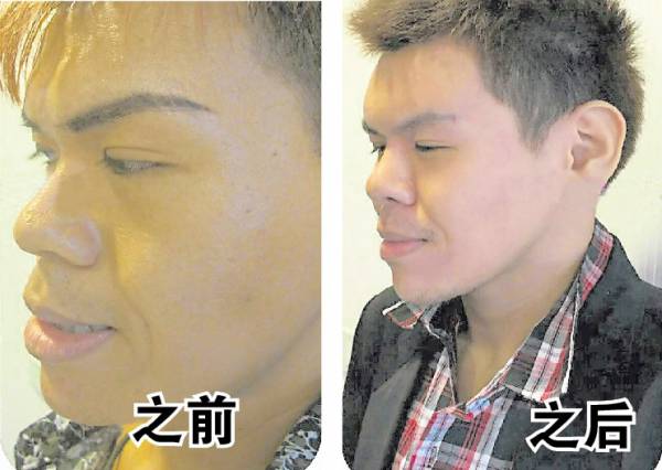 苹果中肌下榻