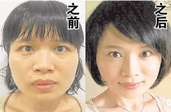 菱形脸问题