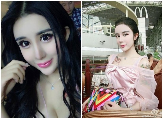 李蒽熙15岁就开始整型。