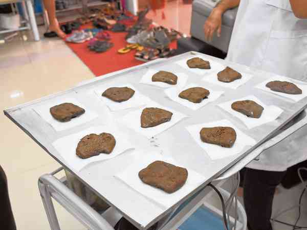 治疗使用的药膏都是陆医师亲自出国采购回来的草药,之后加以提炼制成。