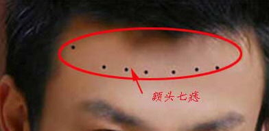 额头上有七痣,就跟脚踩七星一样,此人一定大富大贵,帝王之相.