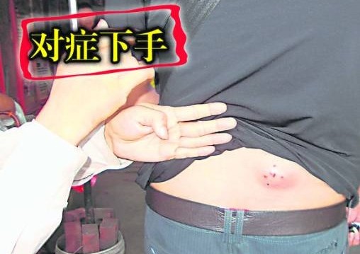 颜医师指出,很多肿毒溃烂都源自肠和血,所以必须对症下药,方能根治。