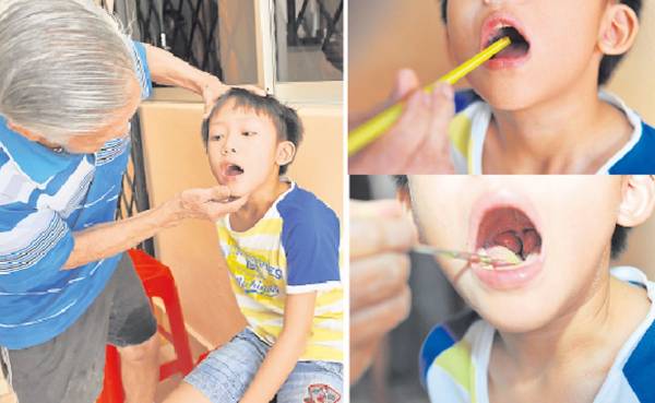 陈老伯替小病人诊疗，然后就用吸管把药粉吹进他的喉咙里。