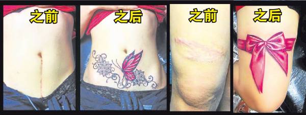 Kinki如魔术师般将表皮上丑陋的疤痕、烙印，以最生动艳丽的纹身变走。