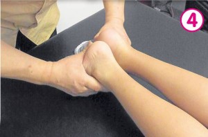 正骨后,陈同学两只脚的长度已明显一致。