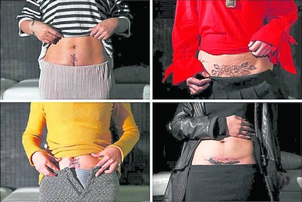 中国一名纹身师，利用纹身替产妇遮盖疤痕，不但令她们重拾信心，也瞬间成为了潮女。