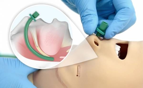 在鼻咽癌初期，医生一般只建议病人接受放射治疗。
