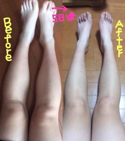 不少女生试过之后都挺满意效果，对比之前的粗腿明显瘦了很多。