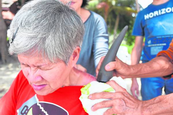 霹雳州红土坎海边出现一位海边怪医，专门以独门的刮痧法替人医病。