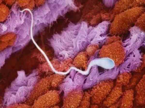 精子还在输卵管里游动的模样。