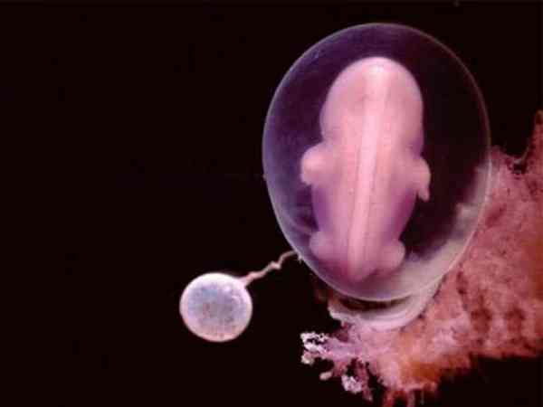  4周大的胎儿，觉得这个画面真的好梦幻，仿佛是在宇宙中的小星球阿...