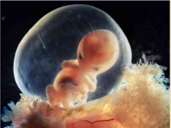 怀孕8周，被胎囊所保护的胎儿正在迅速成长，从这一张照片来看，能够很明显看出来宝宝的样子了。