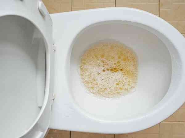 尿液总是起泡泡 这是病吗?