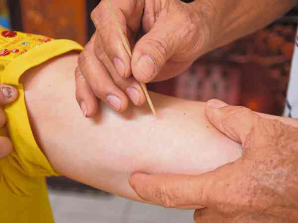 中医叫飞蛇 西医叫带状疱疹 终身埋伏体内 爆发起来疼死人 每日头条