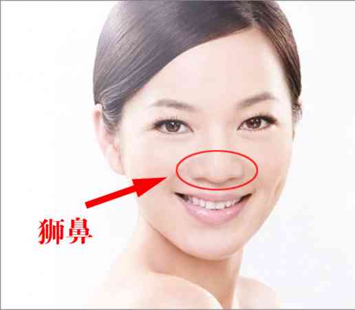 第三种,狮子鼻