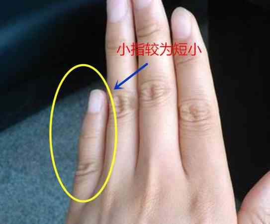 民俗 小指长短隐藏的婚姻分析 如果小拇指的长度低于无名指第三指