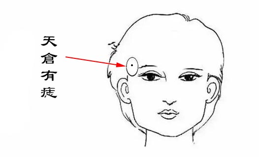 如上图所示,天仓包括左右两个,这两个地方,对应的是辰,未两个位置