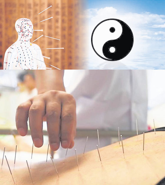 针灸不是每次治疗使用越多支针越好,也讲究阴阳平衡.