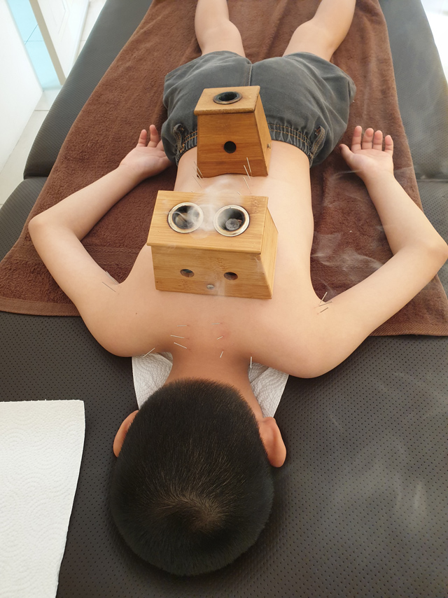 小孩留针的时间较短,但通常都不会少于30分钟。