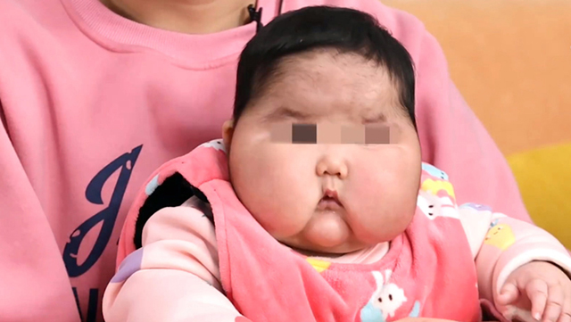 女婴惨变大头娃