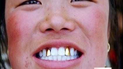 在吞力屯寨子里,男女双方要确定关系,要把女孩好好地牙齿敲掉,镶上金牙。