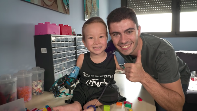 Beknur获David安装LEGO义肢后表现兴奋。