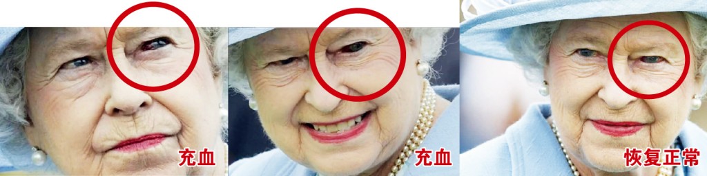 英女王被传疑似蜥蜴人,就是从这个直播的诡异画面传开,可见英女王的左眼忽然充血,其后又恢复正常。