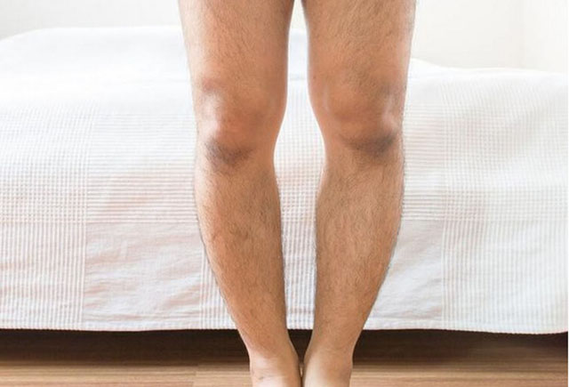 其实男人的腿毛旺盛程度,与遗传因素有很大的关系。