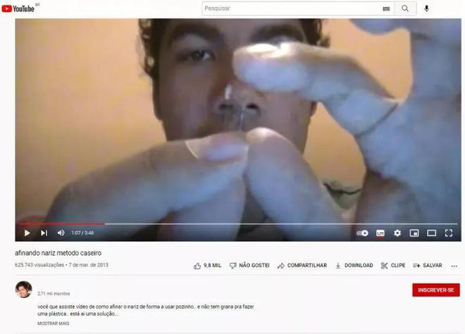 Youtube上教人隆鼻的视频（示意图）