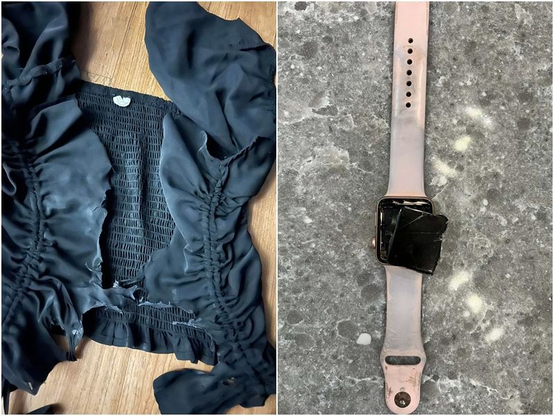 埃格勒穿的衣服被雷劈成两半,连Apple Watch都爆炸。