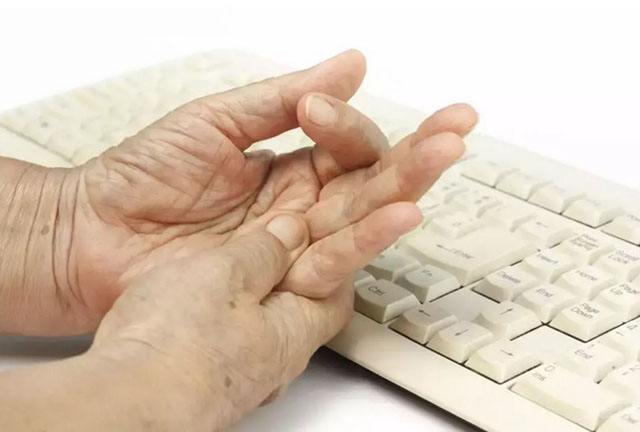 手指长期保持同样姿势，容易造成腕管综合征。