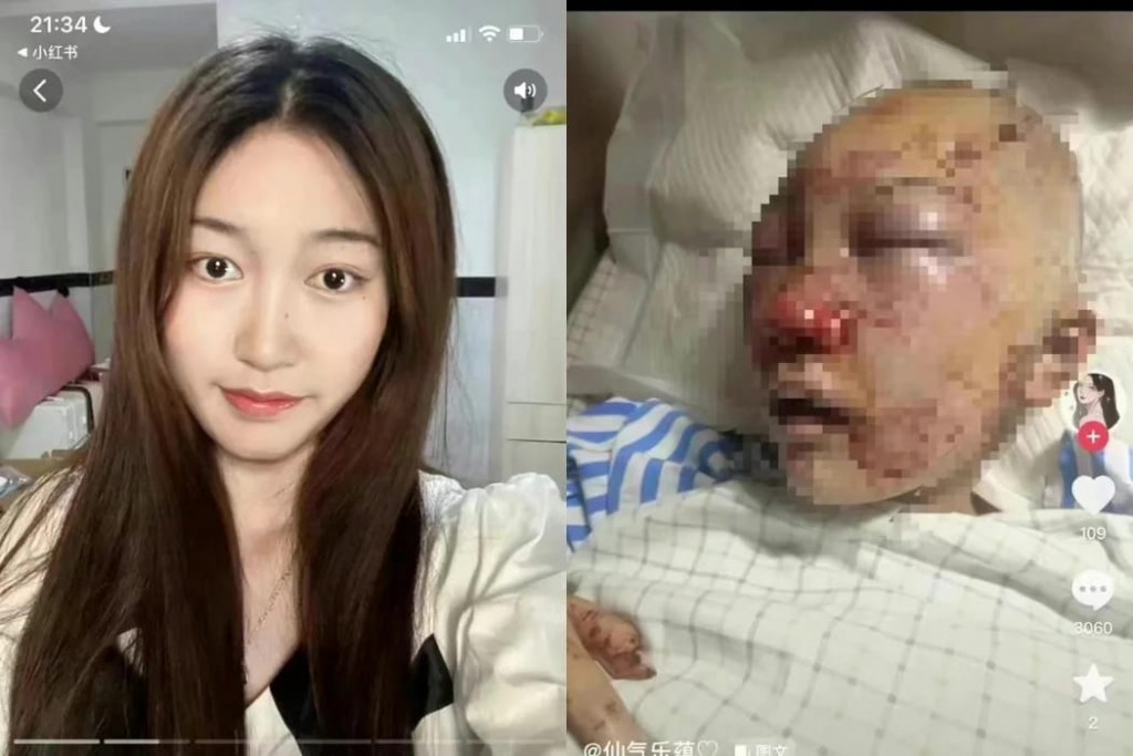 网美被暴打 5