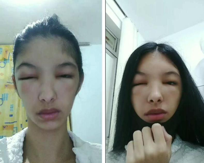 c
