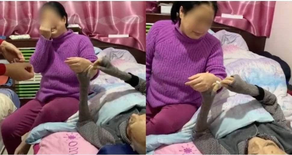 高龄爸爸最后一次针灸 1