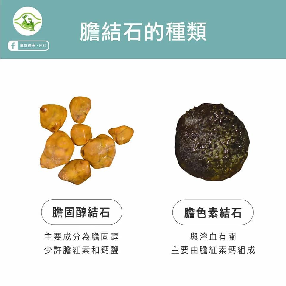 B509EA0A-D6C5-45AB-A5DC-4298B2854F8D
