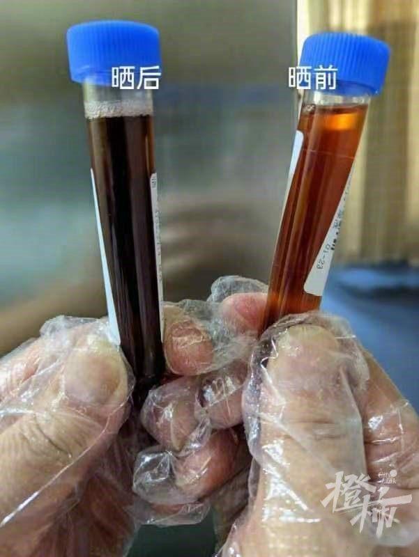女子尿液被收集储存下来,在阳光的照射下,不到半小时,她的尿液就变成了酱油色!