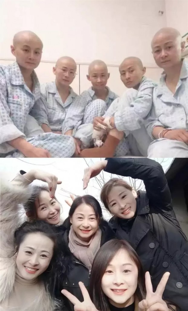 最美5朵金花剃头捐肤救外甥 1