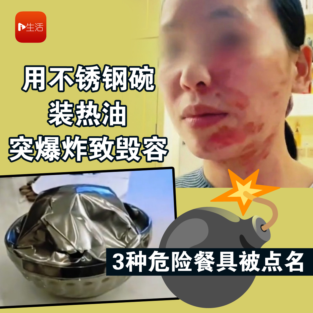 用不锈钢碗装热油 突爆炸致毁容 3种危险餐具被点名